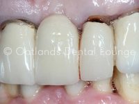 Before - Oatlands Dental Lounge