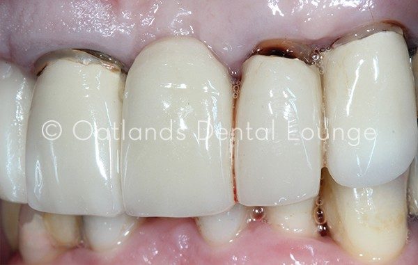 Before - Oatlands Dental Lounge