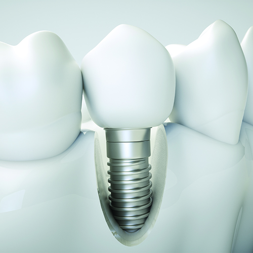 Patient Photo - Oatlands Dental Lounge