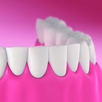 Treatment - Oatlands Dental Lounge