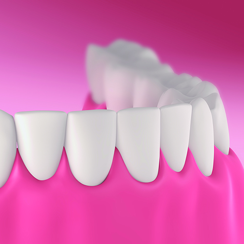 Patient Photo - Oatlands Dental Lounge