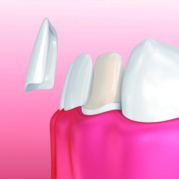 Treatment - Oatlands Dental Lounge