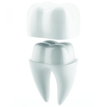 Treatment - Oatlands Dental Lounge