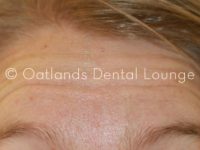 After - Oatlands Dental Lounge