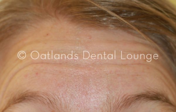 After - Oatlands Dental Lounge