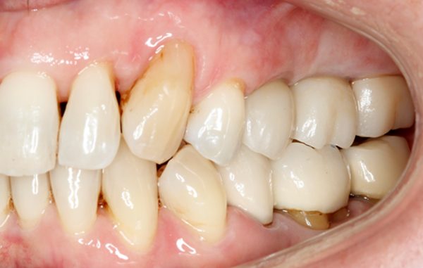 After - Oatlands Dental Lounge