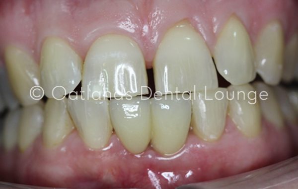 After - Oatlands Dental Lounge