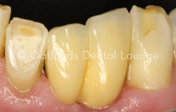 After - Oatlands Dental Lounge