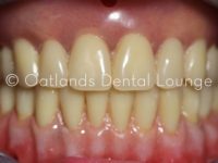 After - Oatlands Dental Lounge