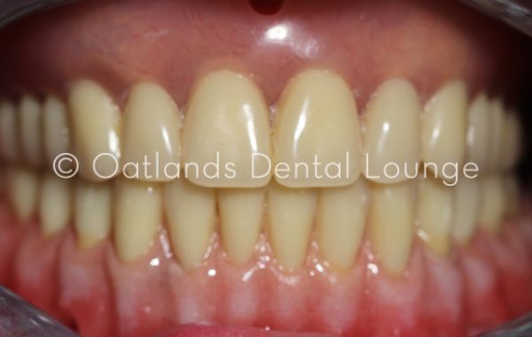 After - Oatlands Dental Lounge