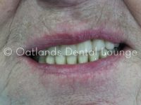 After - Oatlands Dental Lounge