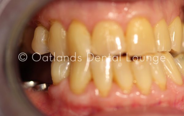After - Oatlands Dental Lounge
