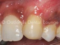 After - Oatlands Dental Lounge