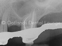 After - Oatlands Dental Lounge