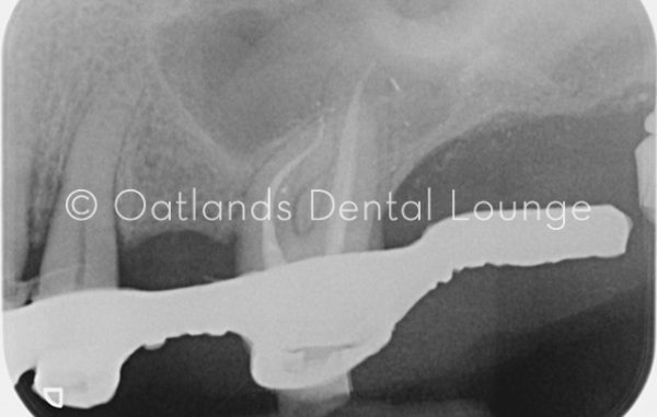 After - Oatlands Dental Lounge