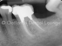 After - Oatlands Dental Lounge