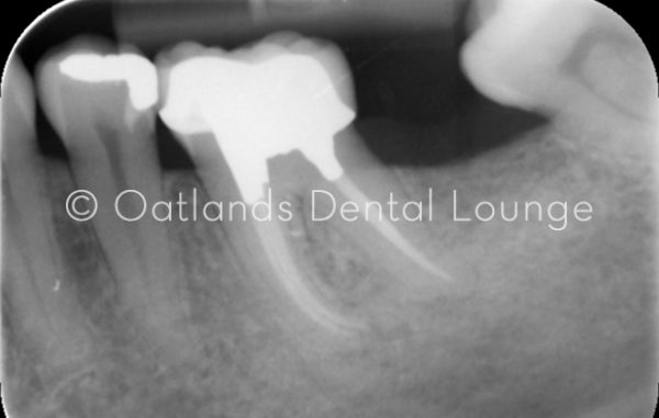 After - Oatlands Dental Lounge