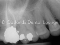 After - Oatlands Dental Lounge