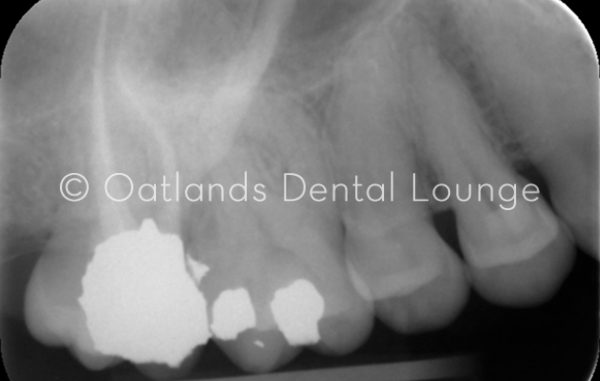 After - Oatlands Dental Lounge