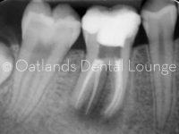 After - Oatlands Dental Lounge