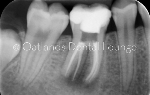 After - Oatlands Dental Lounge