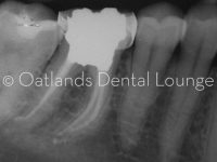 After - Oatlands Dental Lounge