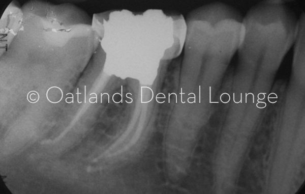 After - Oatlands Dental Lounge