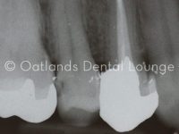 After - Oatlands Dental Lounge