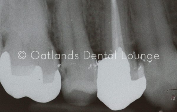 After - Oatlands Dental Lounge