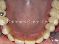 After - Oatlands Dental Lounge