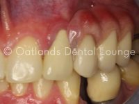 After - Oatlands Dental Lounge