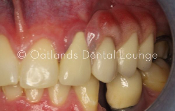 After - Oatlands Dental Lounge