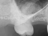 After - Oatlands Dental Lounge