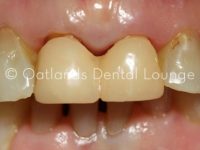 Before - Oatlands Dental Lounge