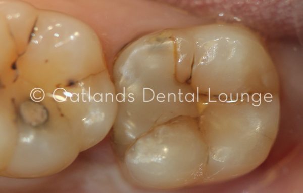 Before - Oatlands Dental Lounge