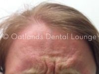 Before - Oatlands Dental Lounge