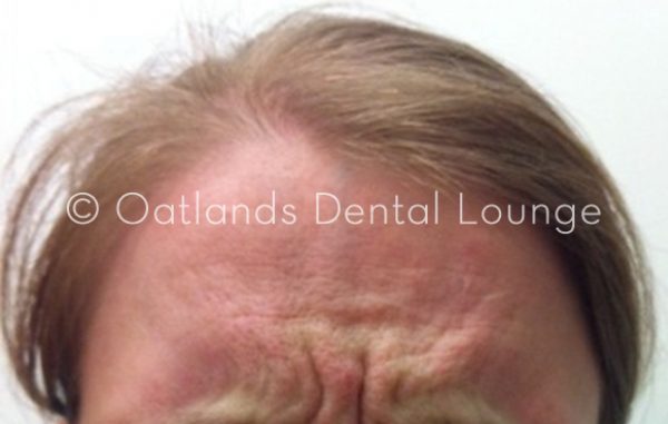 Before - Oatlands Dental Lounge