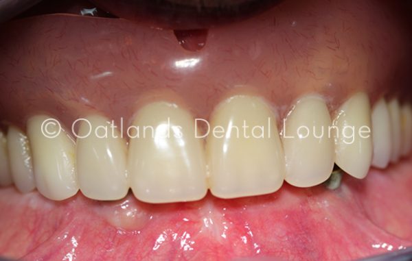 Before - Oatlands Dental Lounge