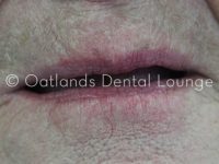 Before - Oatlands Dental Lounge