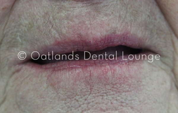 Before - Oatlands Dental Lounge