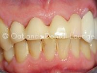 Before - Oatlands Dental Lounge