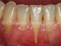 Before - Oatlands Dental Lounge