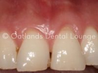 Before - Oatlands Dental Lounge