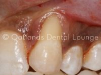 Before - Oatlands Dental Lounge