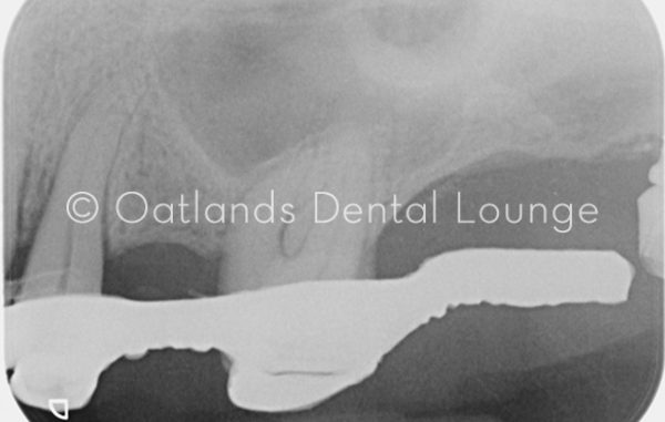 Before - Oatlands Dental Lounge