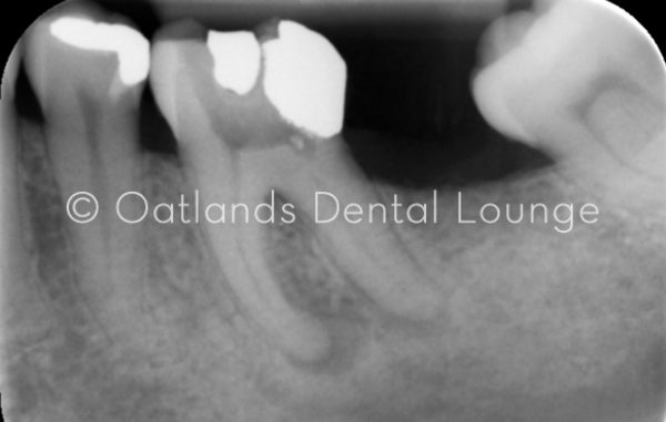 Before - Oatlands Dental Lounge