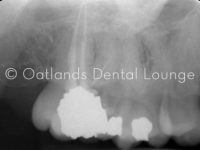Before - Oatlands Dental Lounge