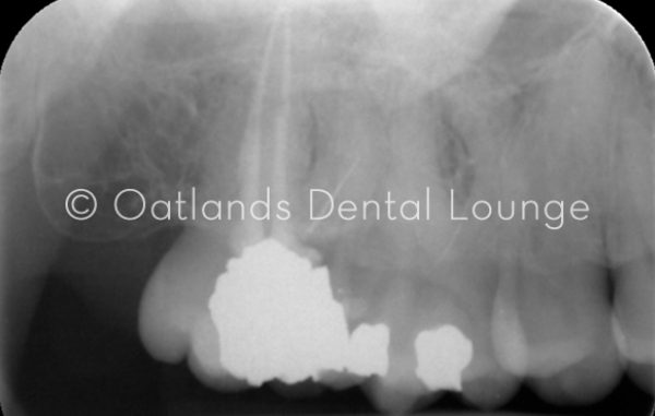 Before - Oatlands Dental Lounge