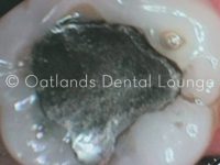 Before - Oatlands Dental Lounge