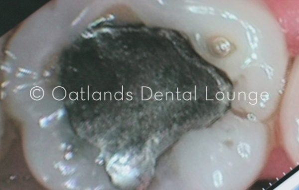 Before - Oatlands Dental Lounge
